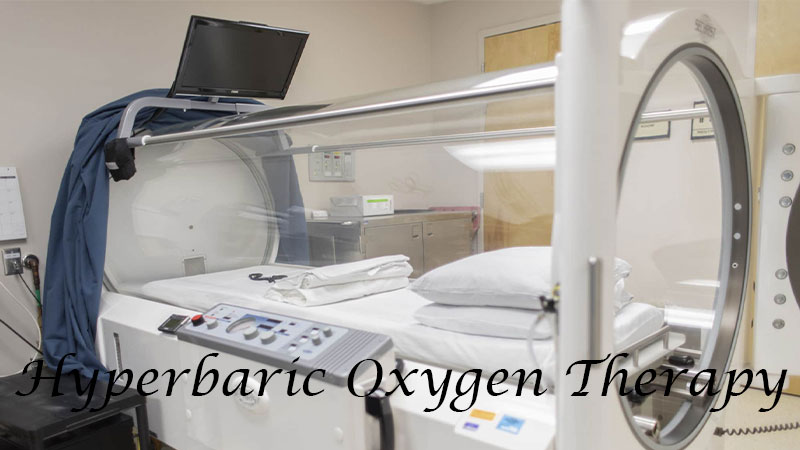 Hyperbaric-Oxygen-Therapy